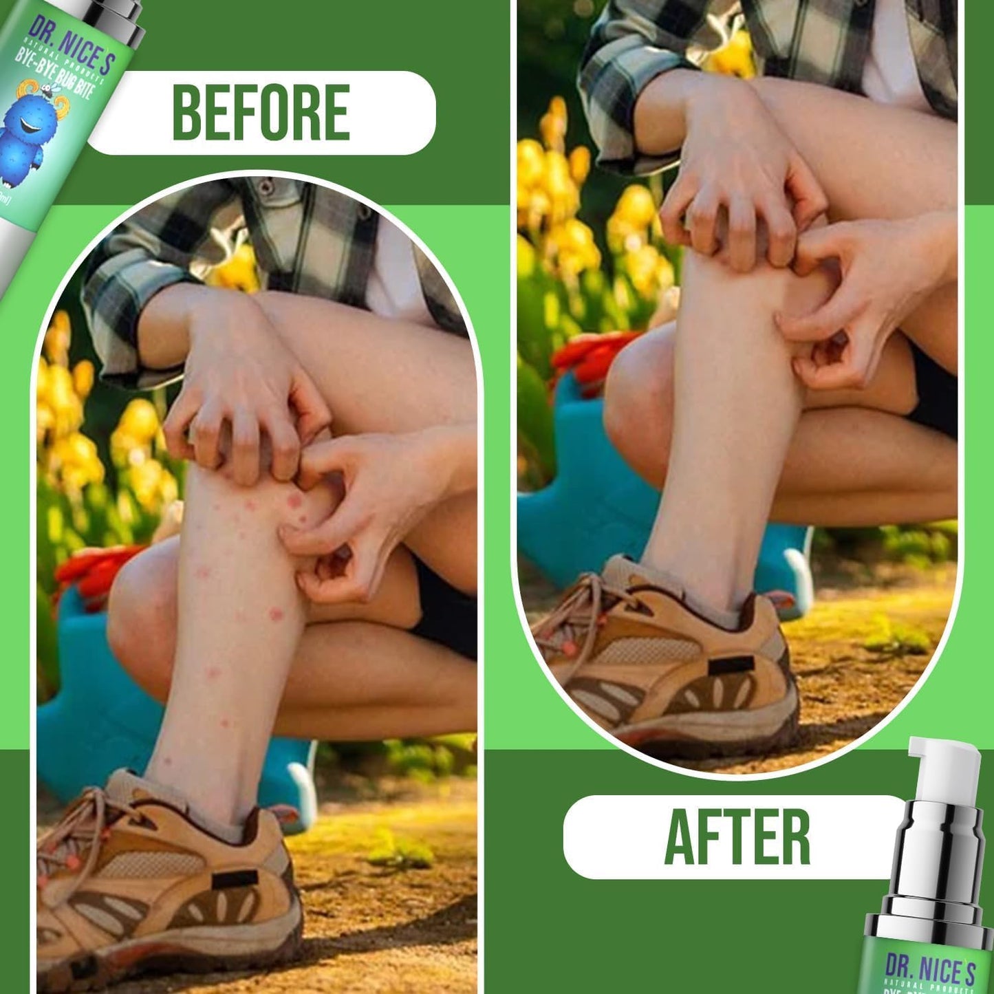 Dr. Nice’s Bye-Bye Bug Bite - Soothing Bug and Mosquito Bite Itch | All Natural | Kid Friendly Self Application | Hydrogel for Bites, Irritation, Skin Discomfort | Soothe Refresh Calm Cool (30 ML)
